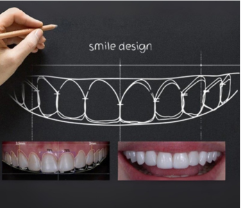 Surgery Icon