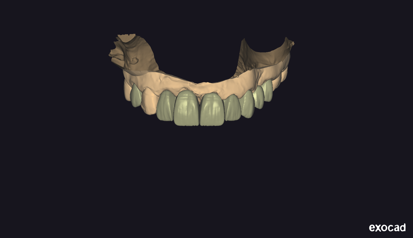 full zircon sur implant